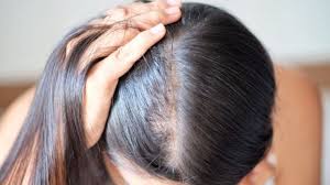 Sağlıklı saçlara giden yol mideden geçiyor