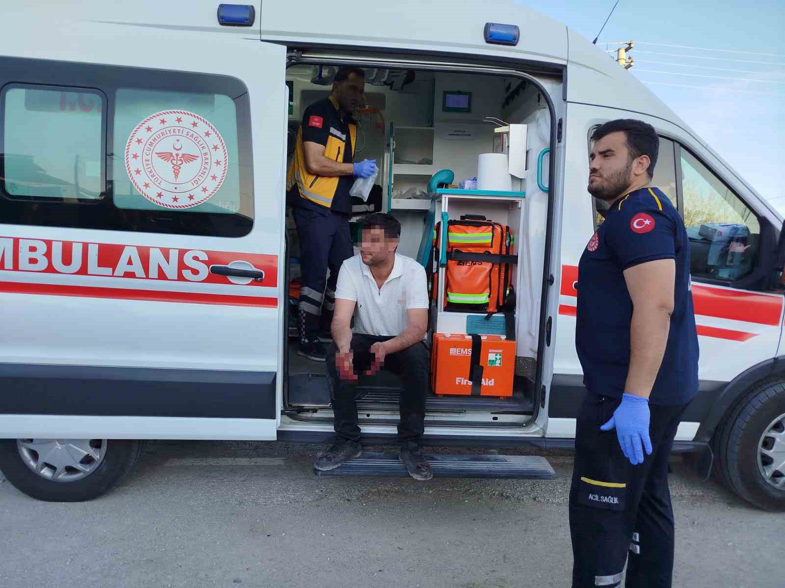 Eski eşlerin arasında çocuk görüş gününde kan aktı