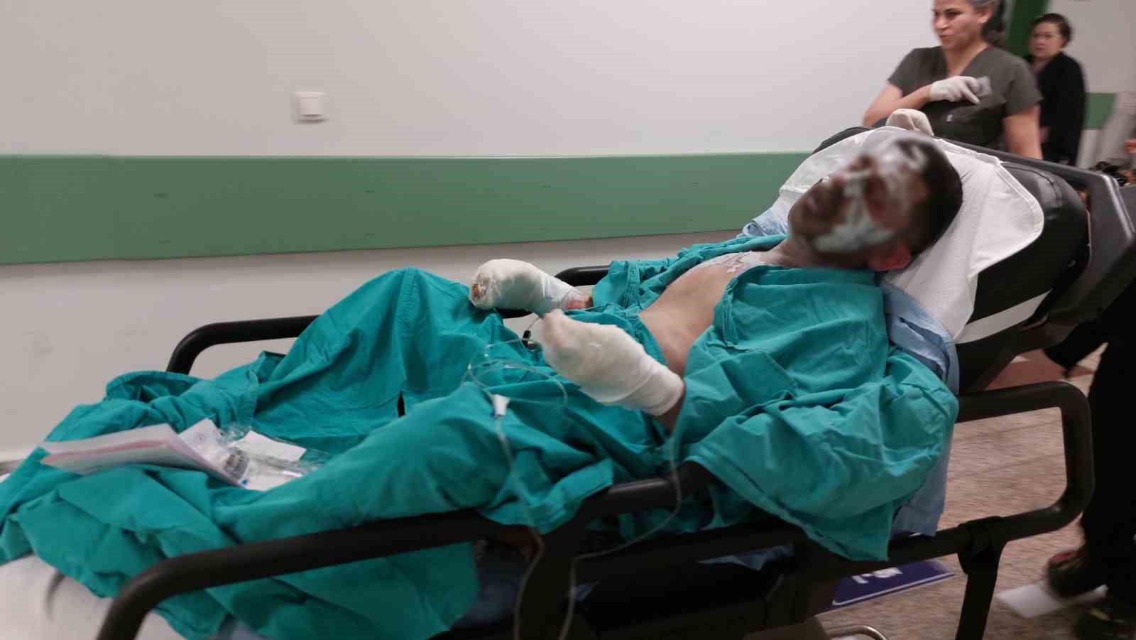 Yaktığı ateşe tiner döken genç ağır yaralandı