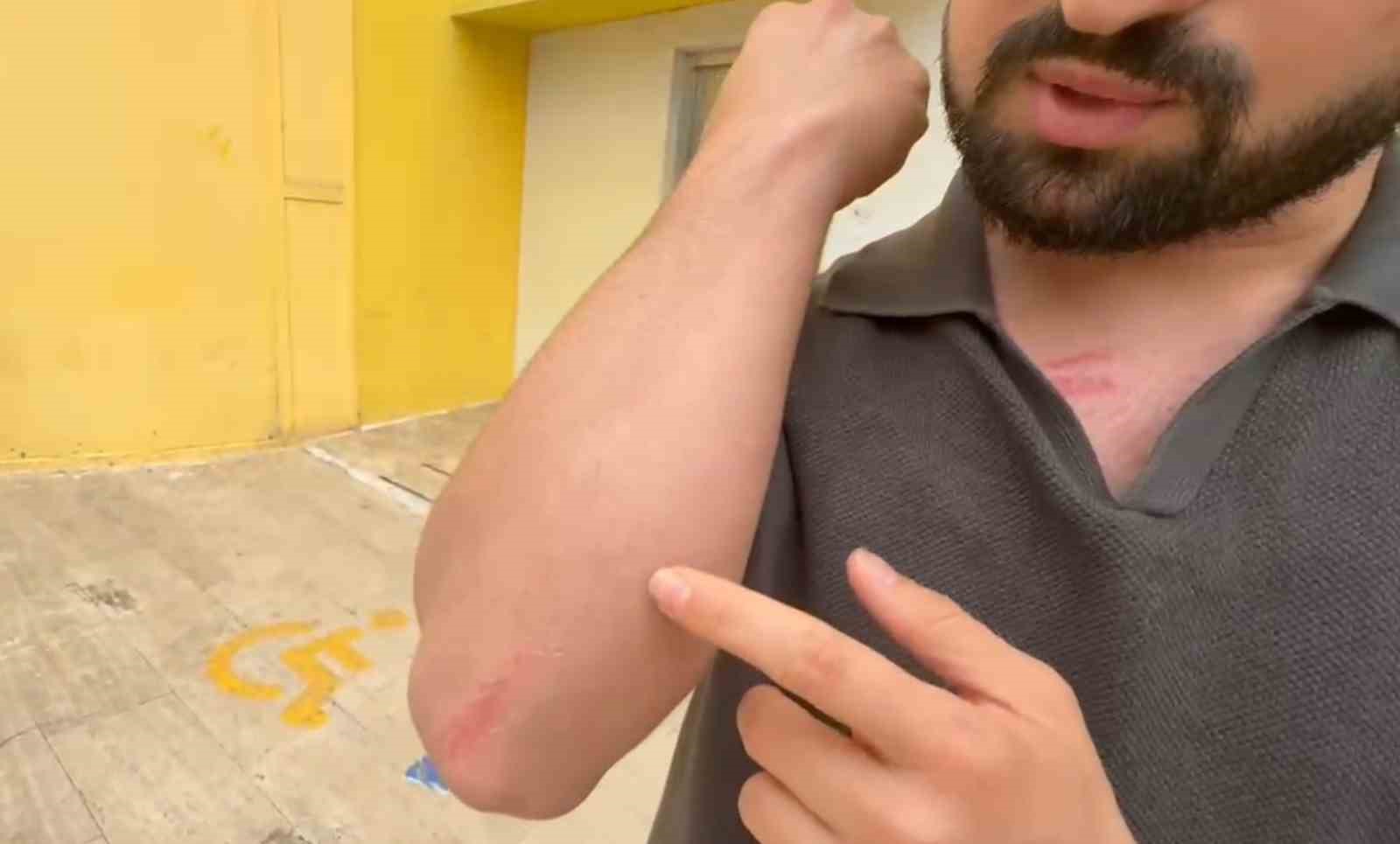 Kına gecesi bitiminde egzoz sesi çıkaran gelin arabasını uyardı, damadın saldırısına uğradı
