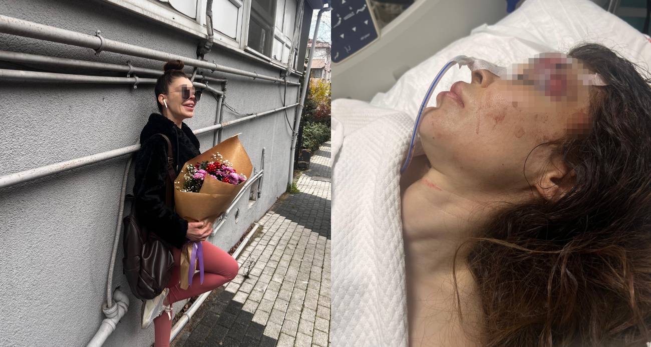 İş görüşmesine giden kadına boks hocasından bıçaklı ve yumruklu saldırı