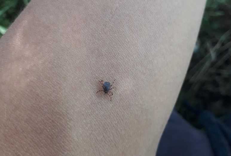 Kene çıkarırken yapılan hatalar ölümle sonuçlanabiliyor!