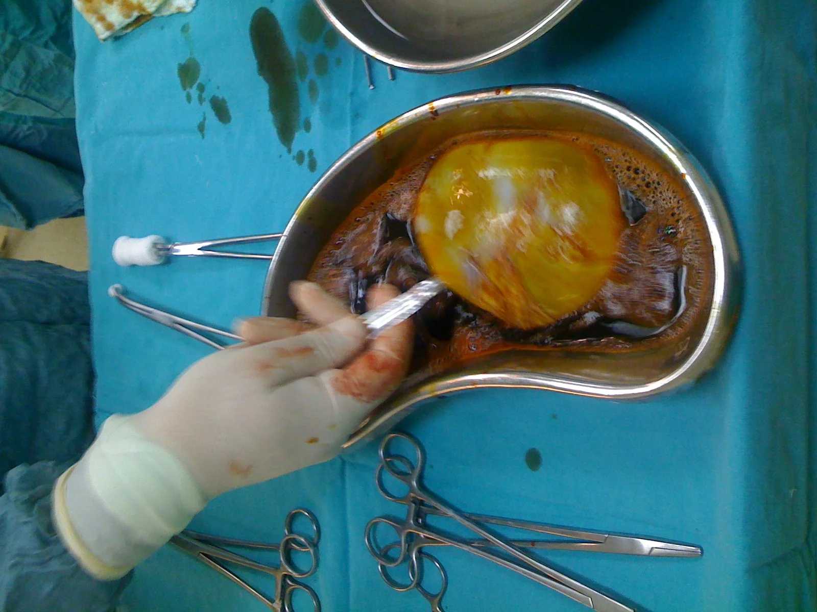 Kurban Bayramında “Kist Hidatik” tehlikesi