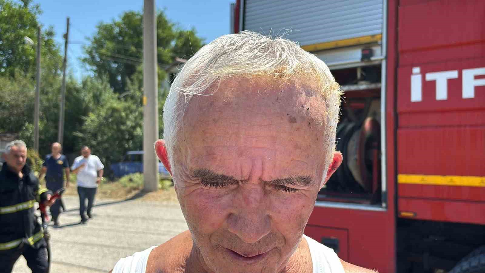 Ateşin Kontrolünü Kaybetti: Kendini Yaktı