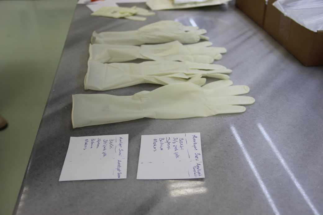 Bu eldiven sağlık alanında çığır açacak: Türk bilim insanları geliştirdi!