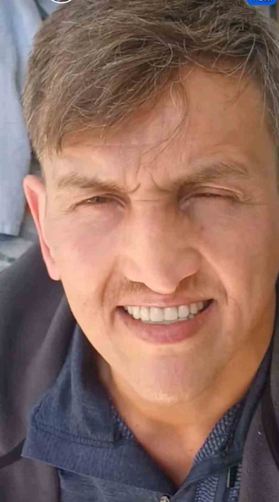 Estetik ameliyatı sonrası hayatını kaybetti