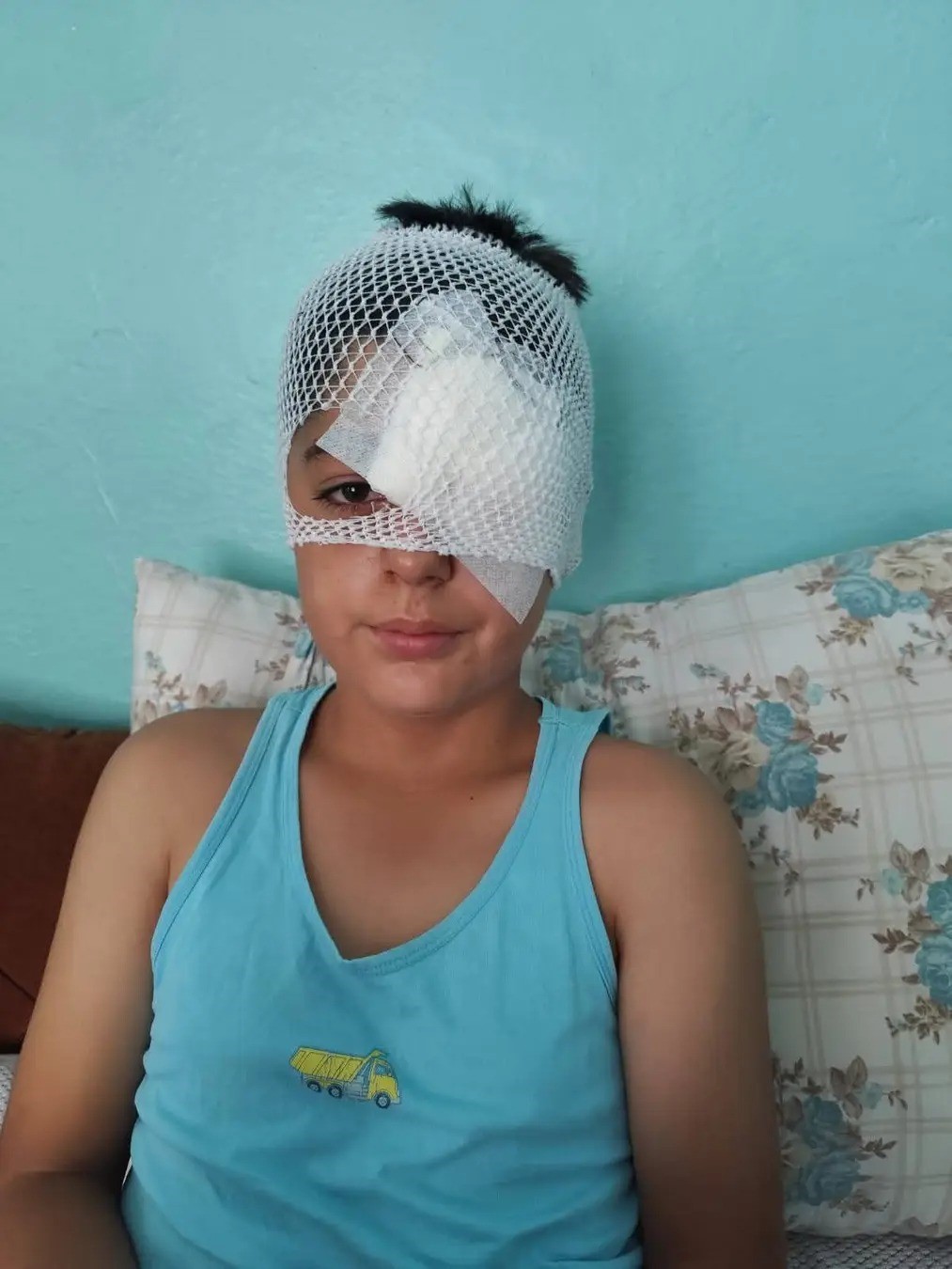 Köpek saldırısından kaçan çocuğa otomobil çarptı