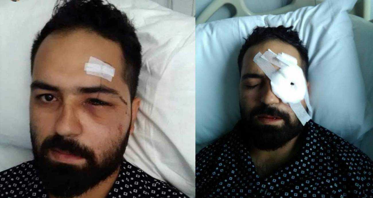 15 Temmuz Gazisi Akkoç: “Darbeci asker dalga geçer bir ses tonu ile ‘sen kelime-i şehadet getir’ dedi”