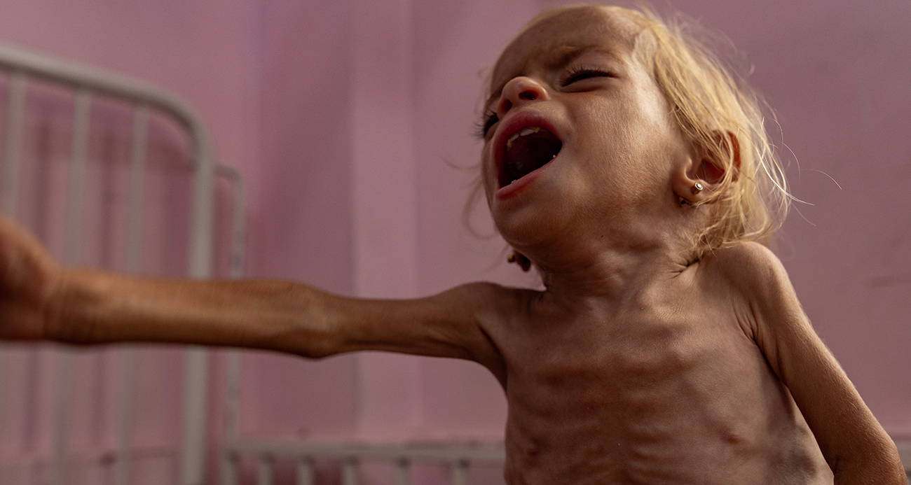 Gazze’de açlık nedeniyle 3 Filistinli daha yaşamını yitirdi