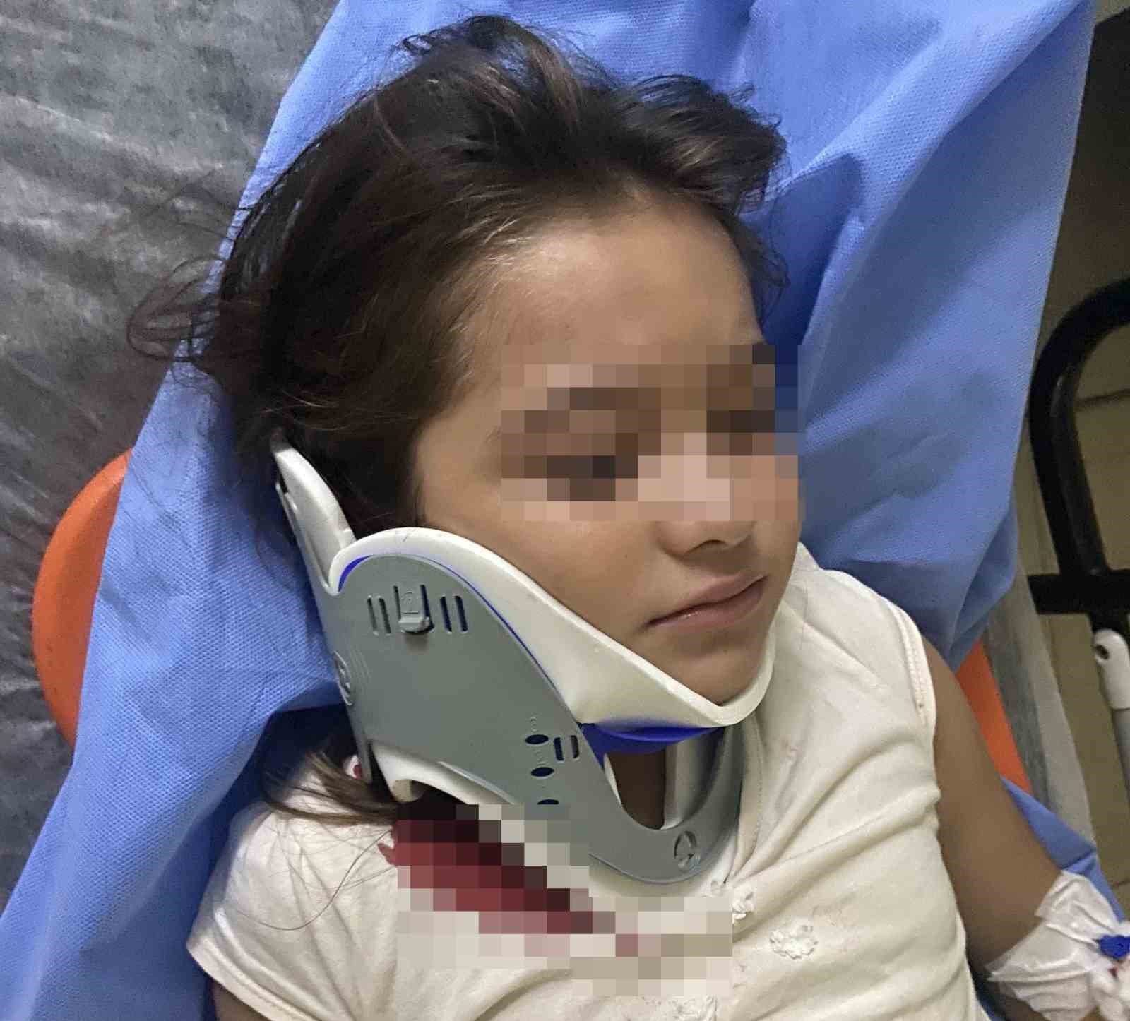 Ters şeritten gelen scooter, 8 yaşındaki çocuğa çarptı