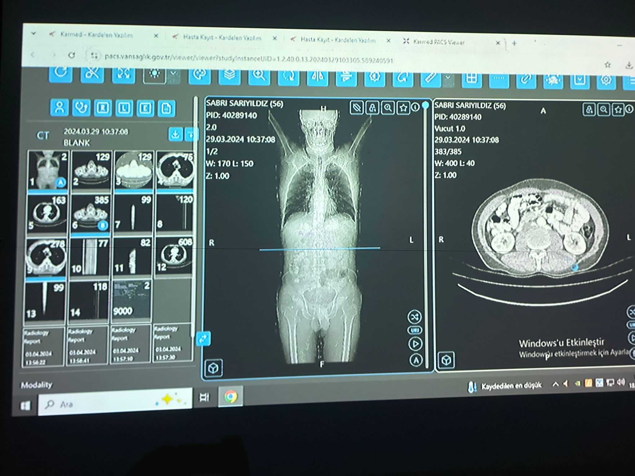Türkiye’de ilk kez Van’da: Cerrahlar yapay zekâdan destek aldı