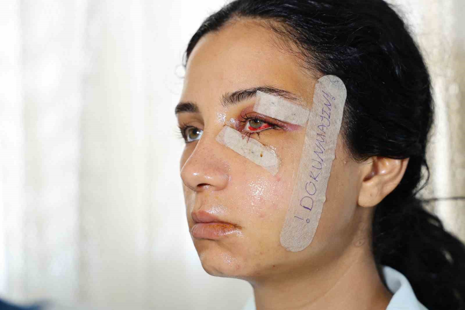 Eşini dövüp serbest kalan şüpheli tutuklandı