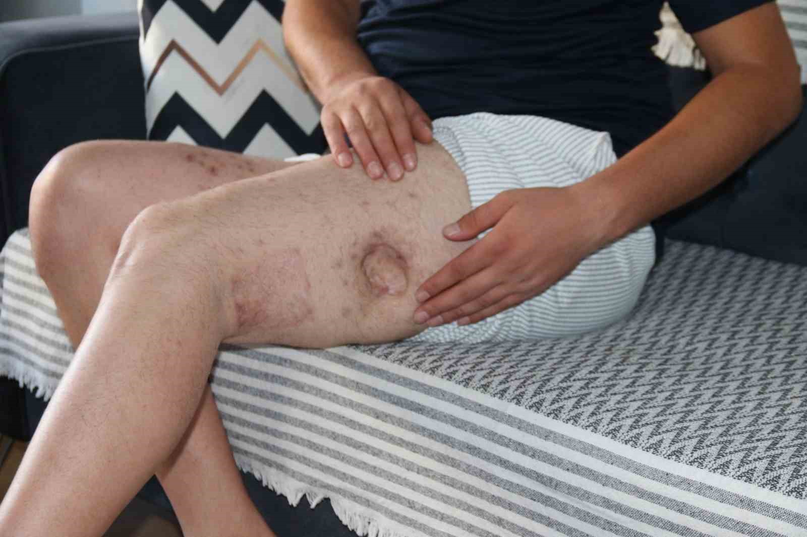 Kendisine iyilik yapmaya çalışan akrabasını önce vurdu, sonra da icra davası açtı