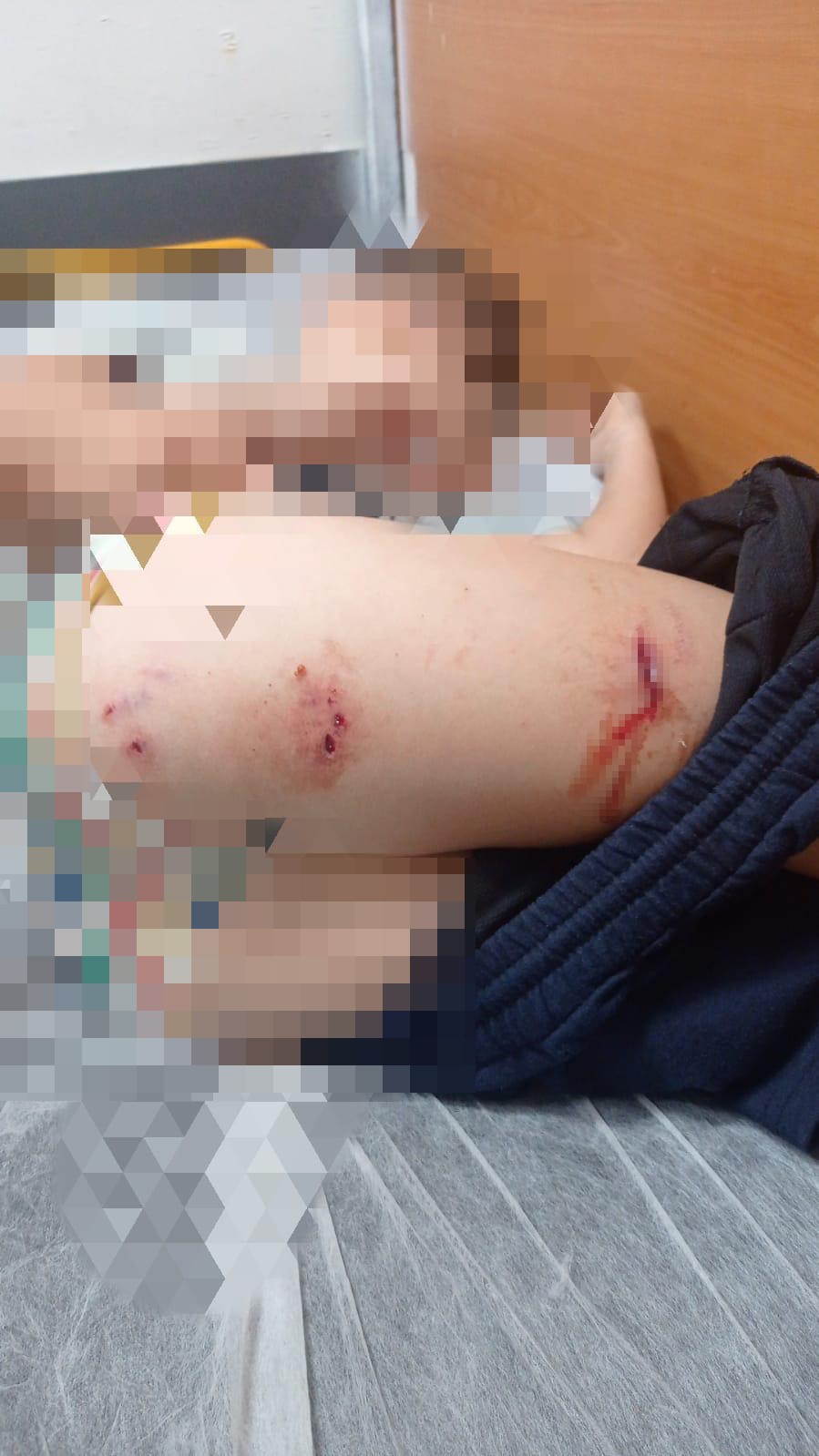 Sokak köpekleri faciaya neden oluyordu