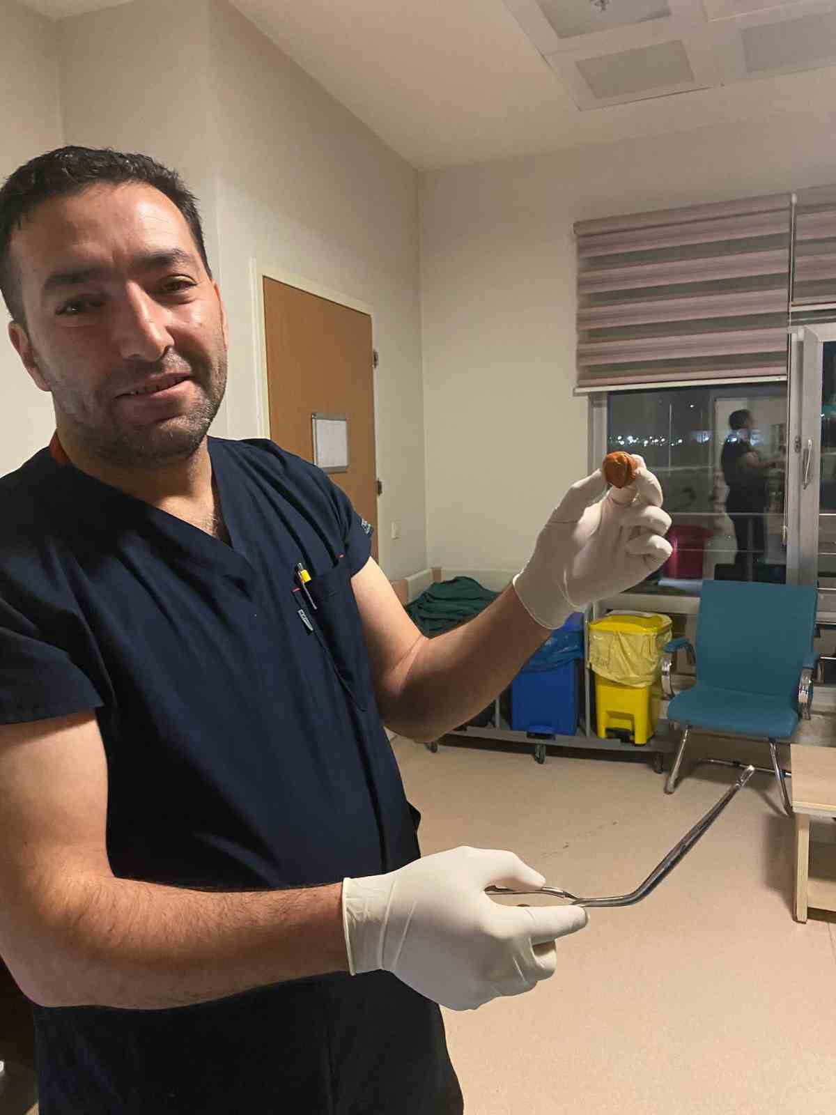 Yuttuğu ceviz yemek borusundan çıkarıldı