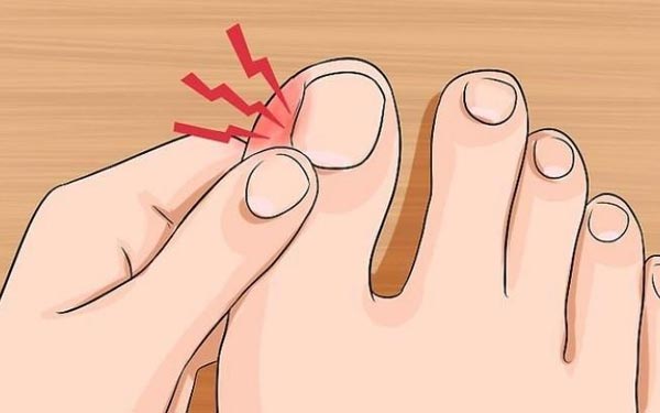 Tırnak Batması Küçük Bir Sorun Değil! İhmal Edilirse Ameliyat Gerekebiliyor