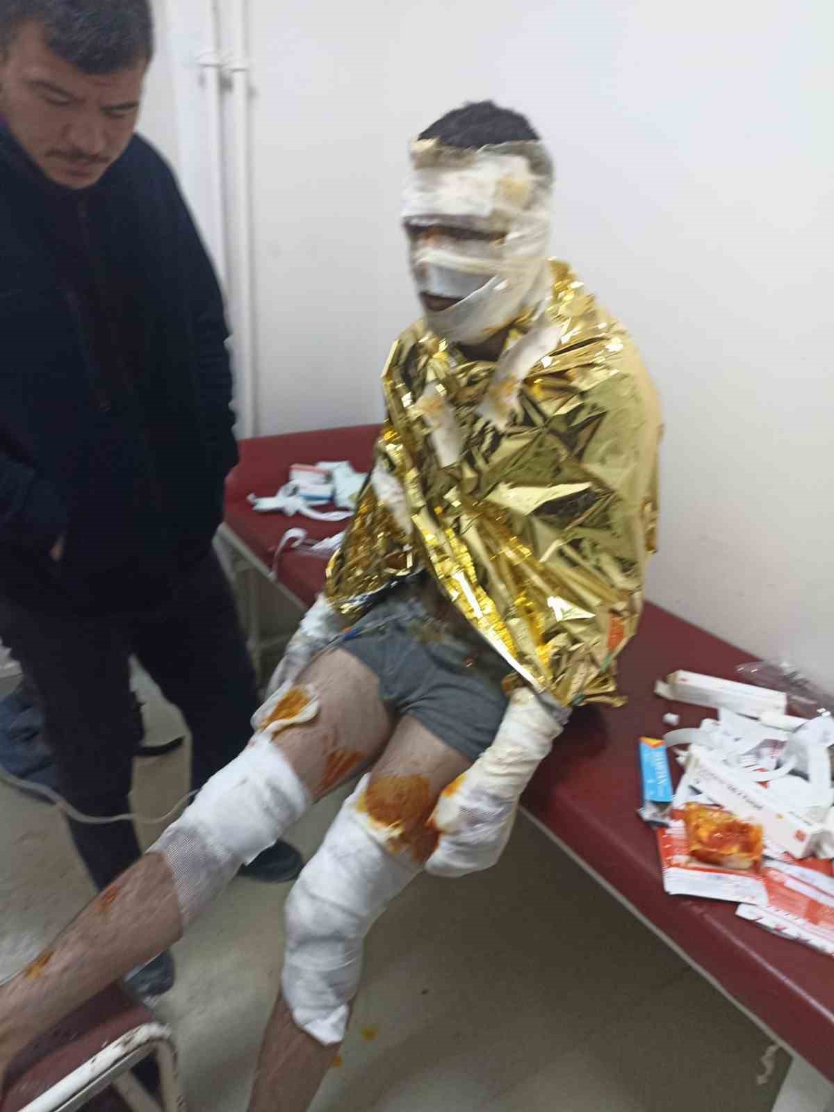 Erzincan’da kömür ocağında yangın: 2 işçi yaralı