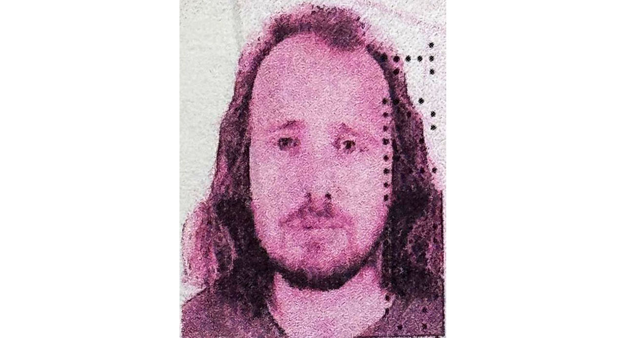 Saç Ekimi ve Diş Tedavisi İçin Türkiye’ye Gelen İngiliz Vatandaş Yaşamını Yitirdi