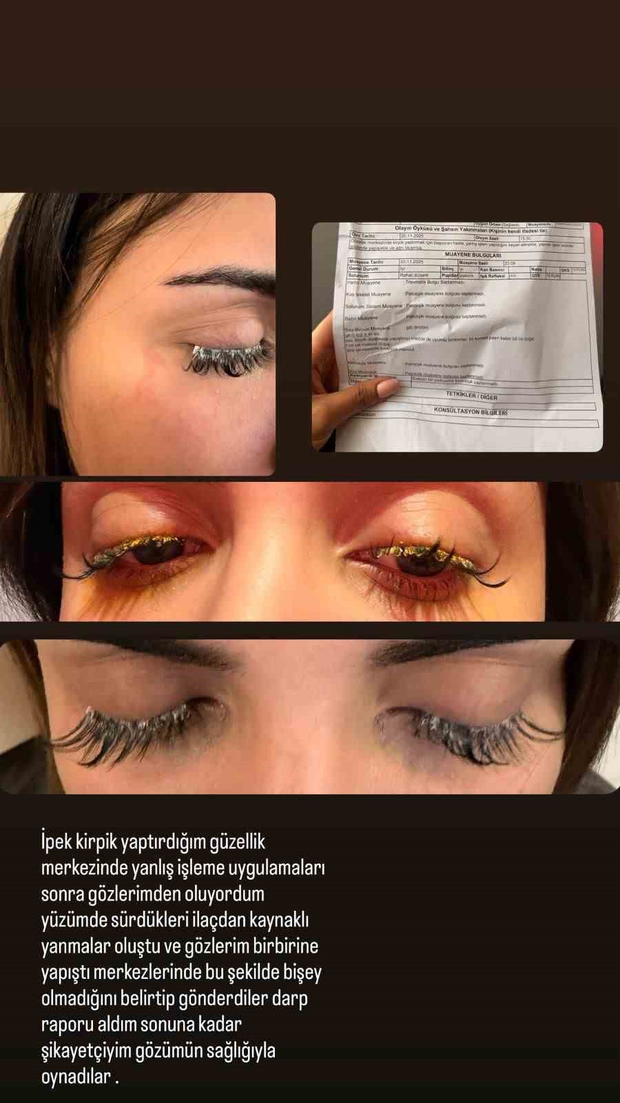 Güzellik merkezinde genç kadının gözüne yapıştırıcı kaçtı: 