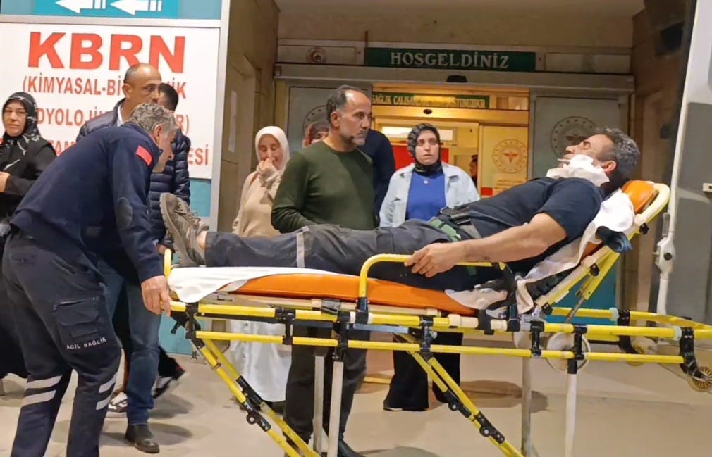 Kömürleri indirirken yüzüne demir saplandı