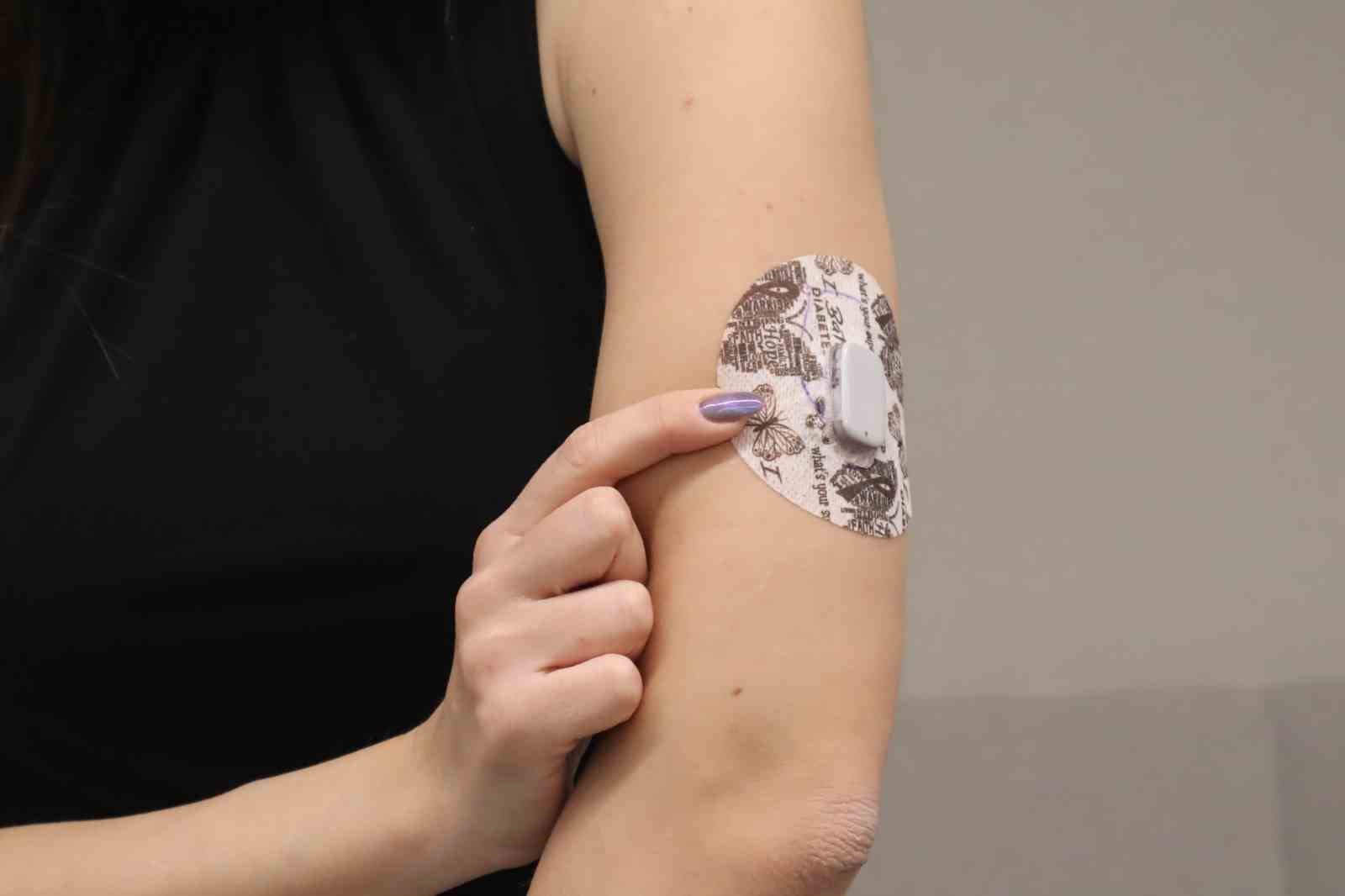 Diyabet tedavisinde “Yapay Pankreas” dönemi başlıyor