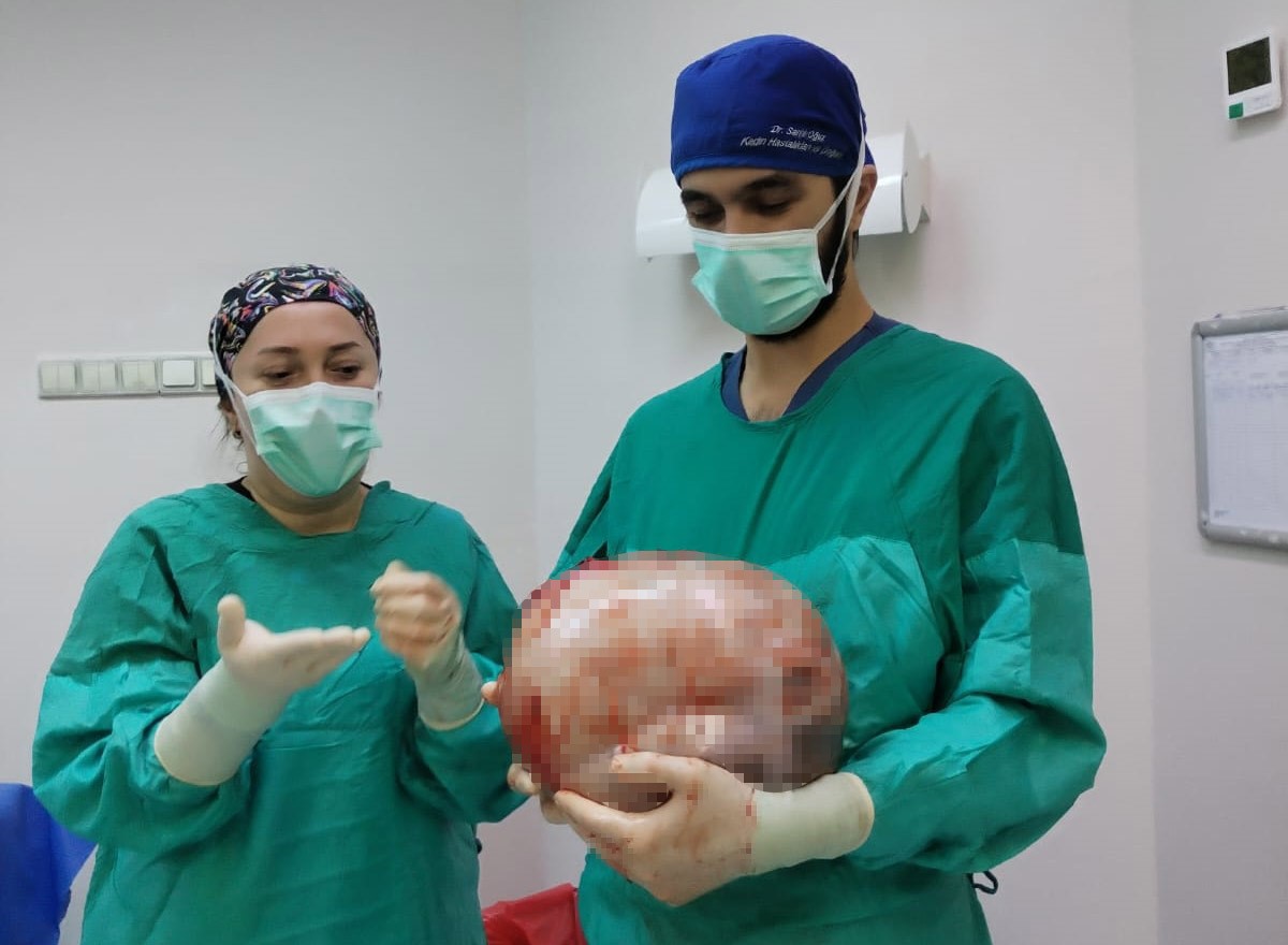 Karnından 8,5 Kilo Ağırlığında Kitle Çıkarılan Kadın Sağlığına Kavuştu