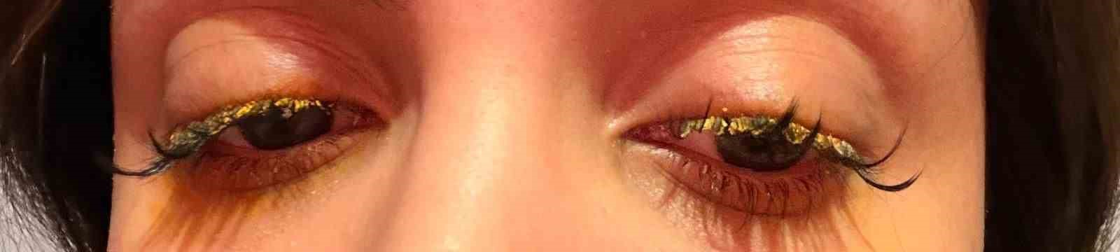 Kirpiklerini yaptırmak isterken, az kalsın gözlerinden oluyordu