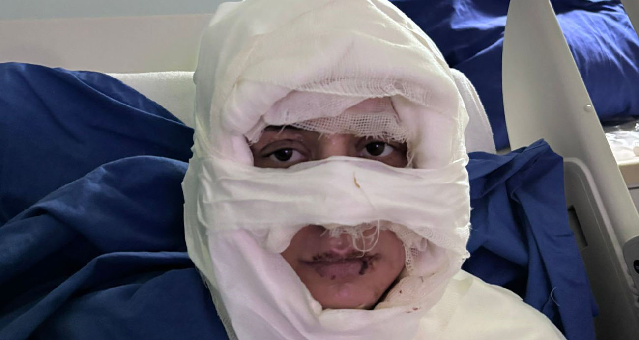 Akıl almaz olay: Genç kadın başka bir kadın tarafından ateşe verildi